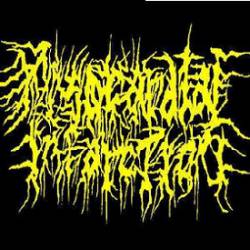 Myocardial Infarction : Demo Myocardial Infarction : Demo